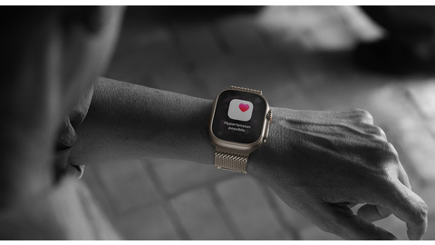 Apple Watch Ultra 3 (2)